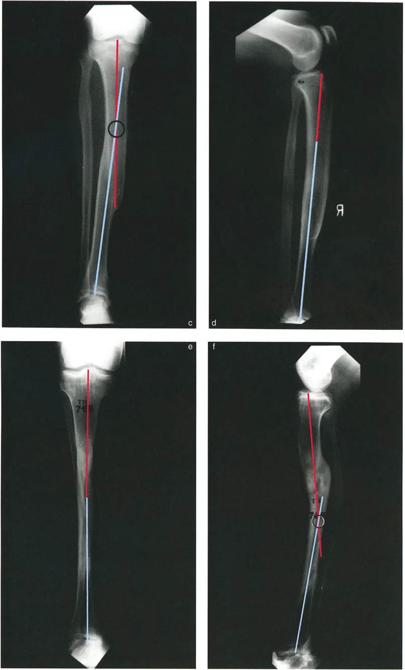 صورة توضيحية لـ تشوهات الانحراف والانزياح العظمي: دليل شامل لفهم وعلاج انحرافات العظام المعقدة مع الأستاذ الدكتور محمد هطيف