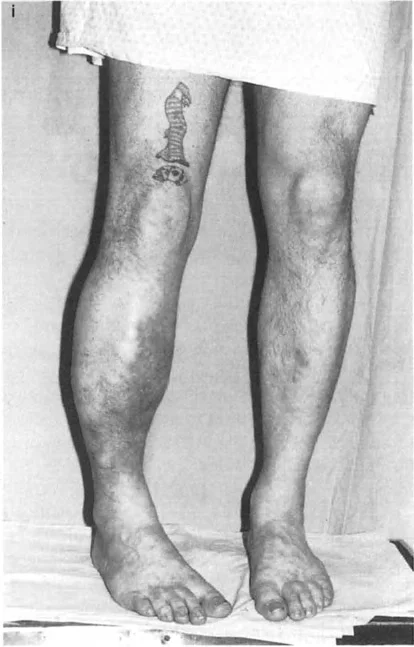 وصف طبي دقيق للمريض