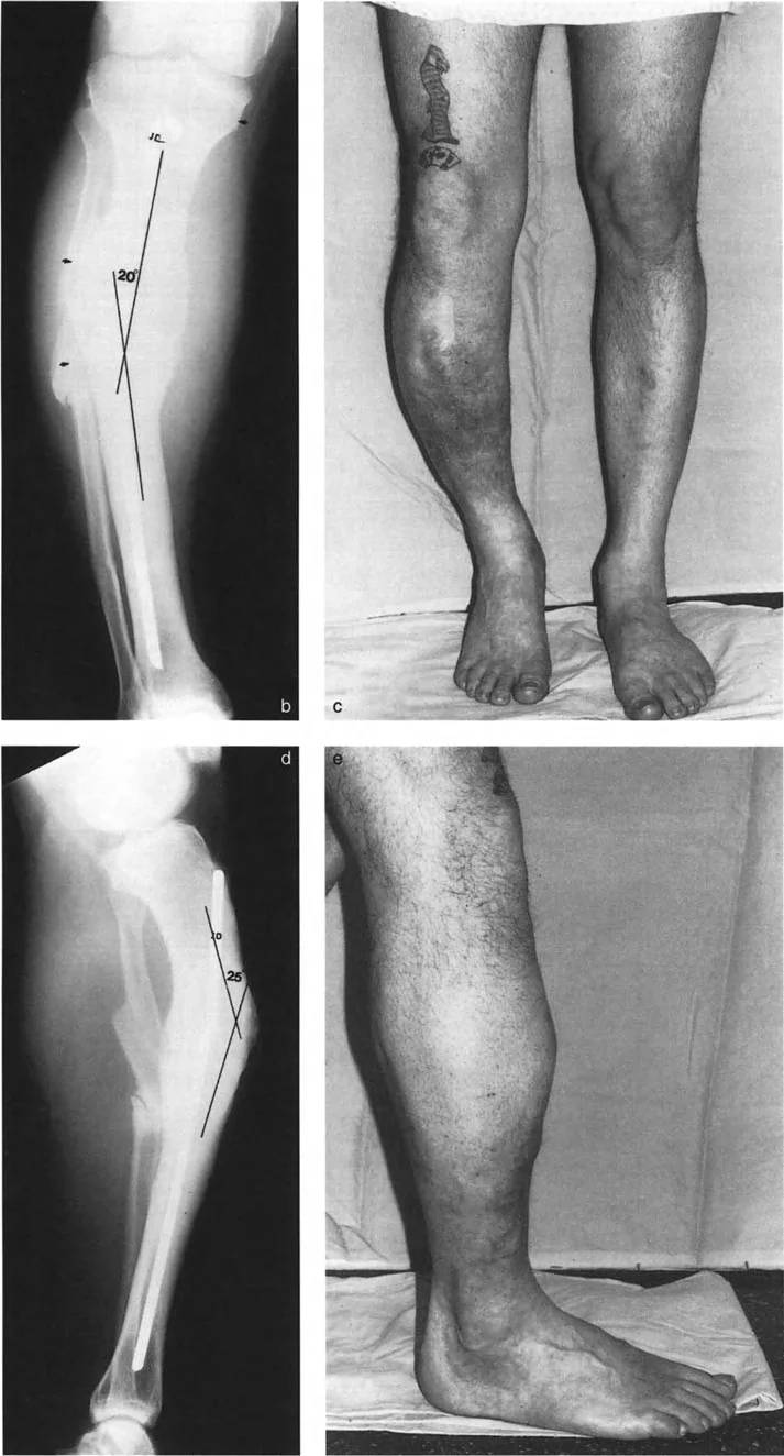 وصف طبي دقيق للمريض