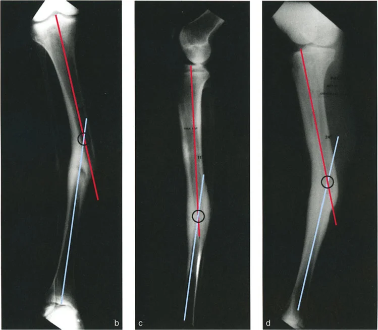 وصف طبي دقيق للمريض