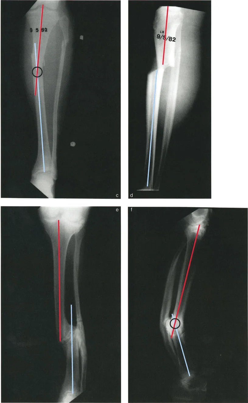 تشوهات الانحراف والانزياح العظمية: فهم شامل وعلاج متقدم مع الأستاذ الدكتور محمد هطيف في صنعاء
