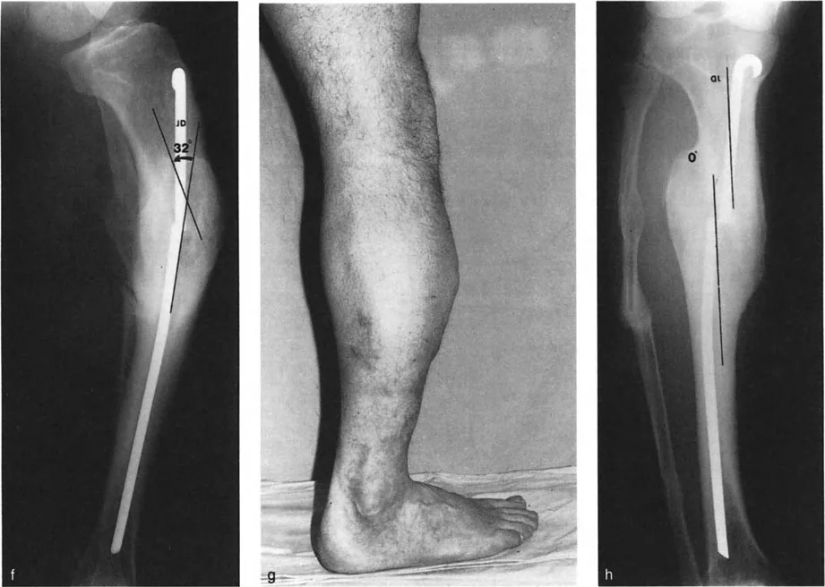 وصف طبي دقيق للمريض