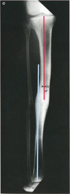 وصف طبي دقيق للمريض