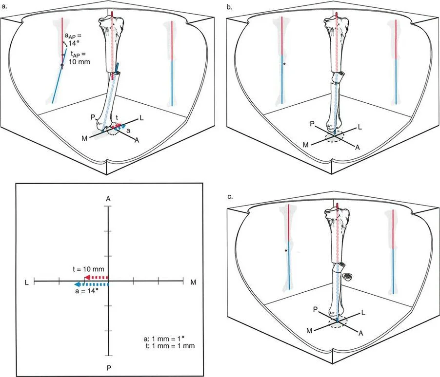 وصف طبي دقيق للمريض