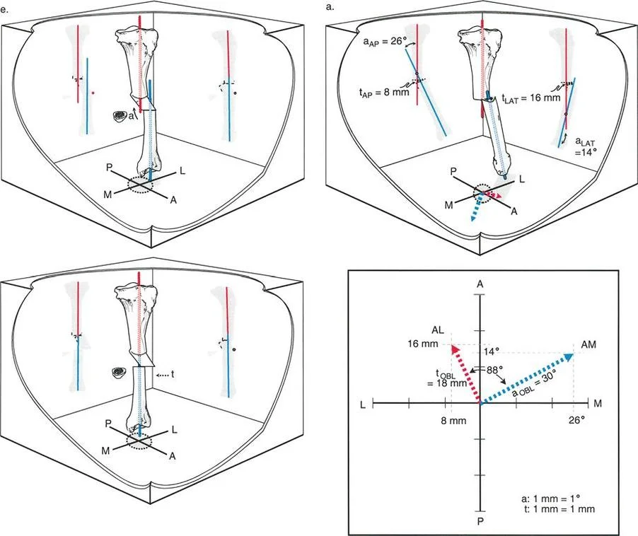 تشوهات الانحراف والترجمة العظمية: دليل شامل لفهم وعلاج حالات التئام العظام المعقدة مع الأستاذ الدكتور محمد هطيف