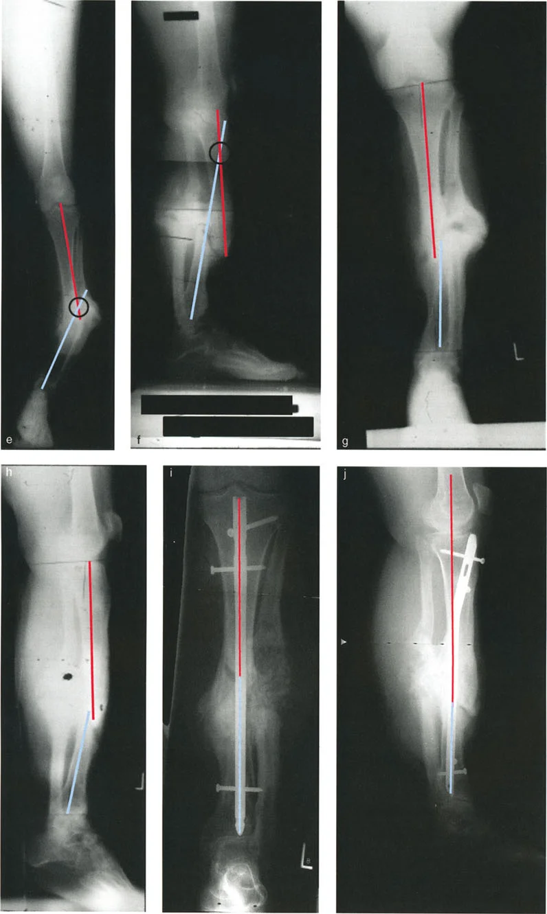 وصف طبي دقيق للمريض
