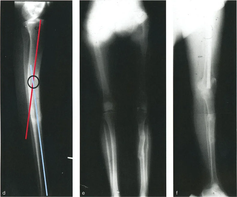 وصف طبي دقيق للمريض