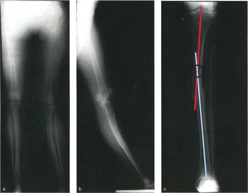 وصف طبي دقيق للمريض