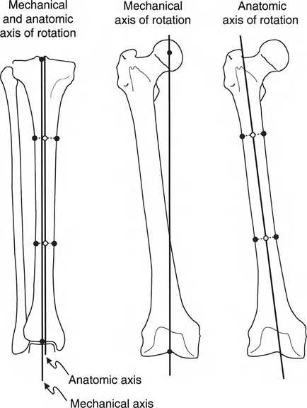 تشوهات الترجمة والانحراف الزاوي في العظام: دليل شامل للعلاج المتقدم مع الأستاذ الدكتور محمد هطيف في صنعاء