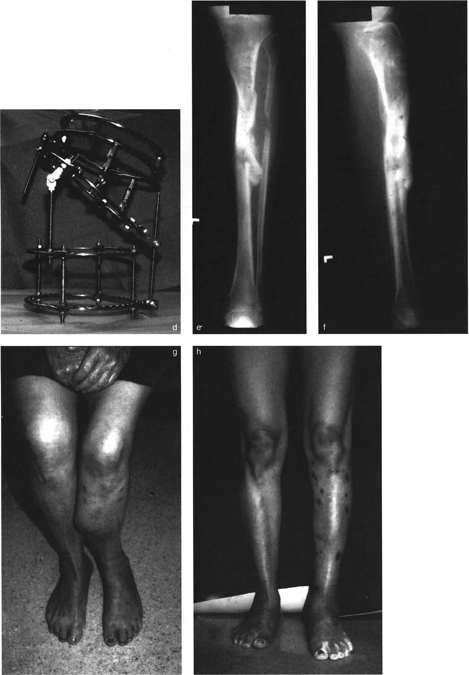 وصف طبي دقيق للمريض