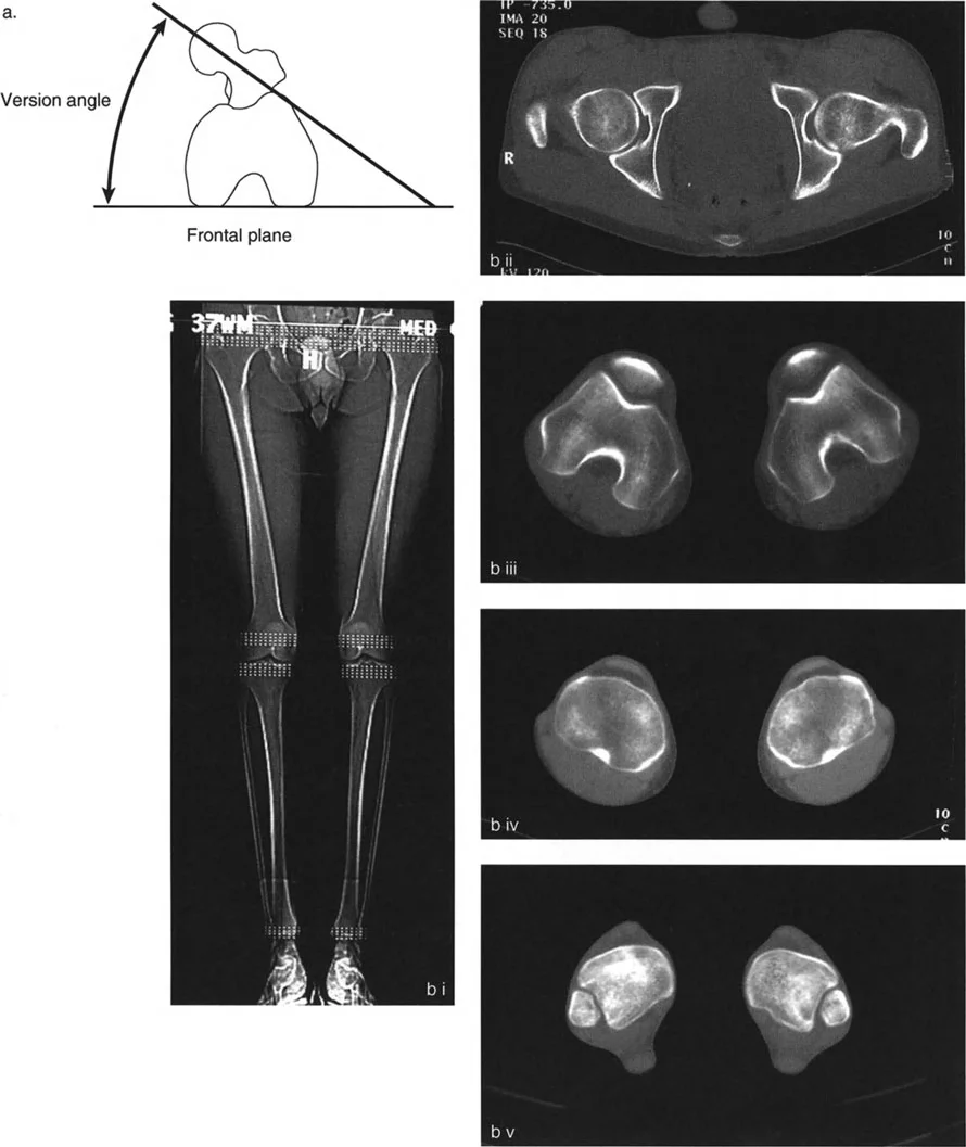 فهم وعلاج التشوهات الدورانية في العظام: خبرة الأستاذ الدكتور محمد هطيف في صنعاء