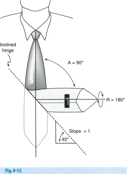 تشوهات الانحراف والدوران في العظام: الحل الجراحي المتقدم بقطع مائل واحد لاستعادة وظيفة الأطراف