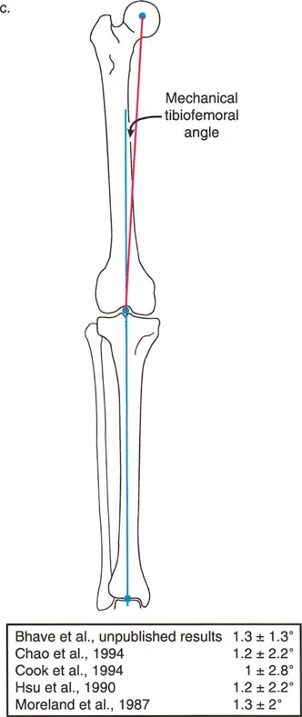 تقويم اعوجاج الأطراف السفلية وتوجيه المفاصل: دليل شامل لمبادئ بالي مع الأستاذ الدكتور محمد هطيف