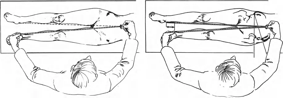 تفاوت طول الأطراف: دليلك الشامل لتصحيح فرق طول الساقين مع الأستاذ الدكتور محمد هطيف