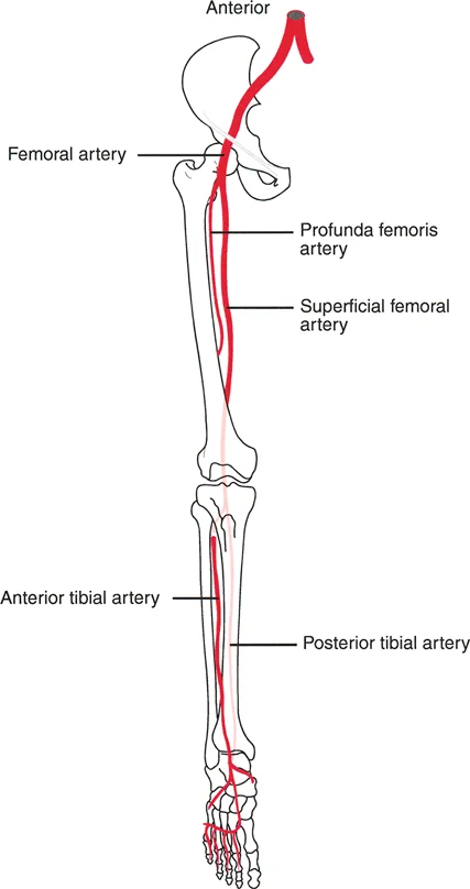 صورة طبية: تصحيح تفاوت طول الساقين وتشوهات الأطراف: مقارنة بين الجراحة الفورية والتدريجية