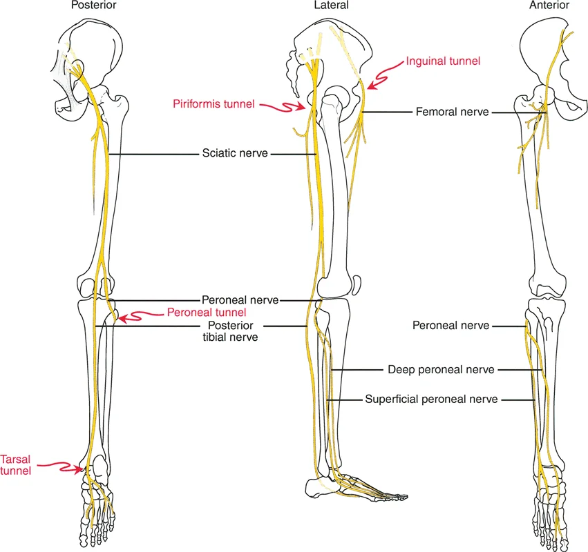 صورة طبية: تصحيح تفاوت طول الساقين وتشوهات الأطراف: مقارنة بين الجراحة الفورية والتدريجية