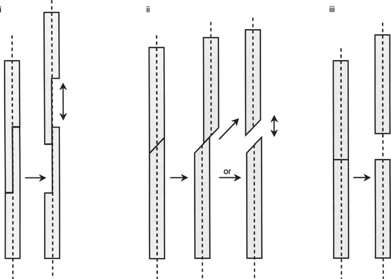 صورة طبية: تصحيح تفاوت طول الساقين وتشوهات الأطراف: مقارنة بين الجراحة الفورية والتدريجية