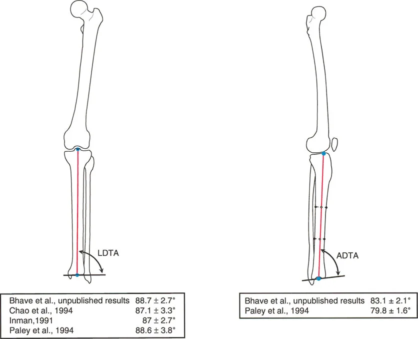 صورة توضيحية لـ فهم محاذاة الأطراف السفلية الطبيعية: دليلك الشامل لصحة المفاصل والحركة السليمة