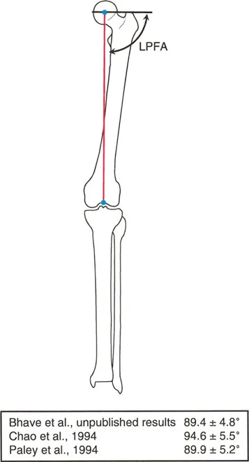 صورة توضيحية لـ فهم محاذاة الأطراف السفلية الطبيعية: دليلك الشامل لصحة المفاصل والحركة السليمة