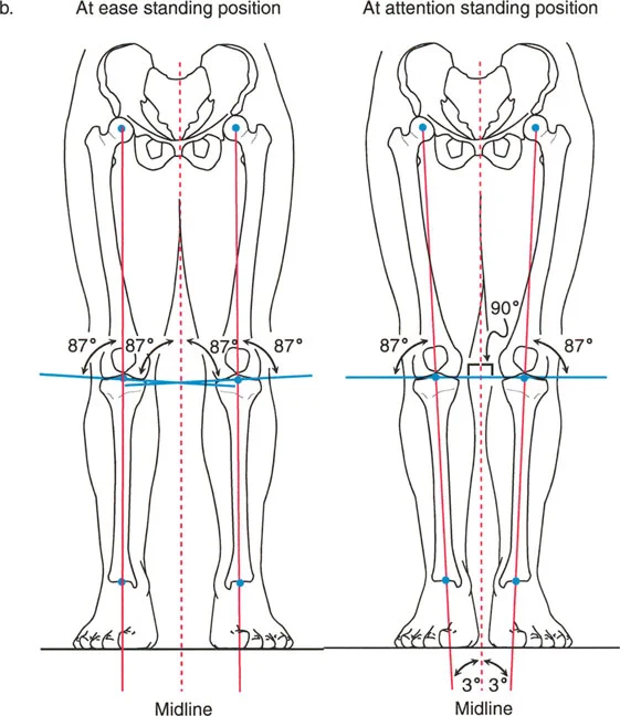 صورة طبية: فهم محاذاة الأطراف السفلية الطبيعية: دليلك الشامل لصحة المفاصل والحركة السليمة