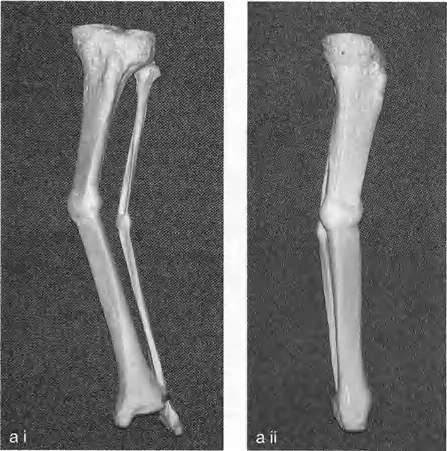 توضيح طبي: تصحيح تشوهات العظام وتطويلها: خبرة الأستاذ الدكتور محمد هطيف في صنعاء