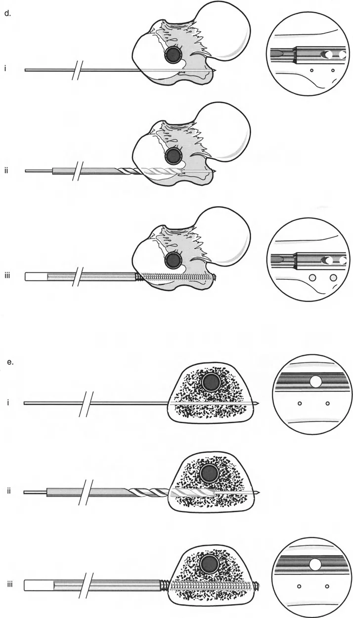 توضيح طبي: تصحيح تشوهات العظام وتطويلها: خبرة الأستاذ الدكتور محمد هطيف في صنعاء