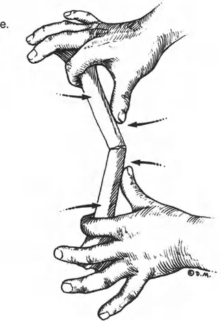 صورة طبية: إتقان مبادئ بالي: الدليل الشامل لأجهزة التثبيت الخارجية وجراحة العظم لتصحيح تشوهات الأطراف