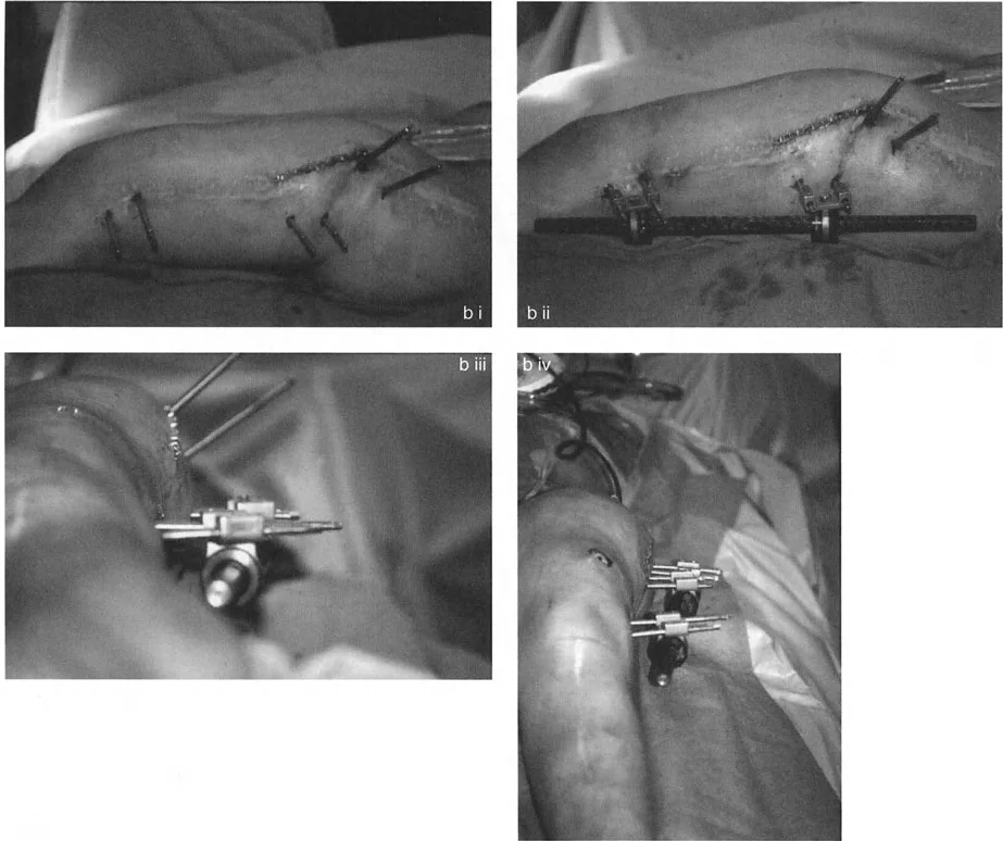 صورة توضيحية لمعدلات الشد