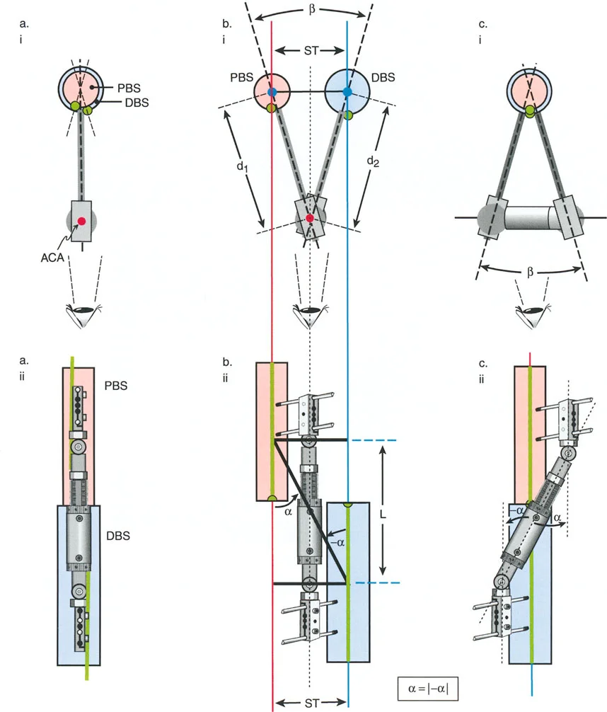 صورة طبية: تصحيح تشوهات العظام بتقنيات بالي المتقدمة الدليل الشامل للمرضى مع الأستاذ الدكتور محمد هطيف