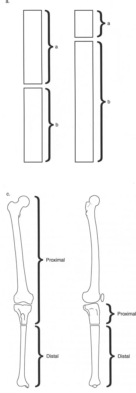 صورة طبية: تصحيح تشوهات العظام بتقنيات بالي المتقدمة الدليل الشامل للمرضى مع الأستاذ الدكتور محمد هطيف