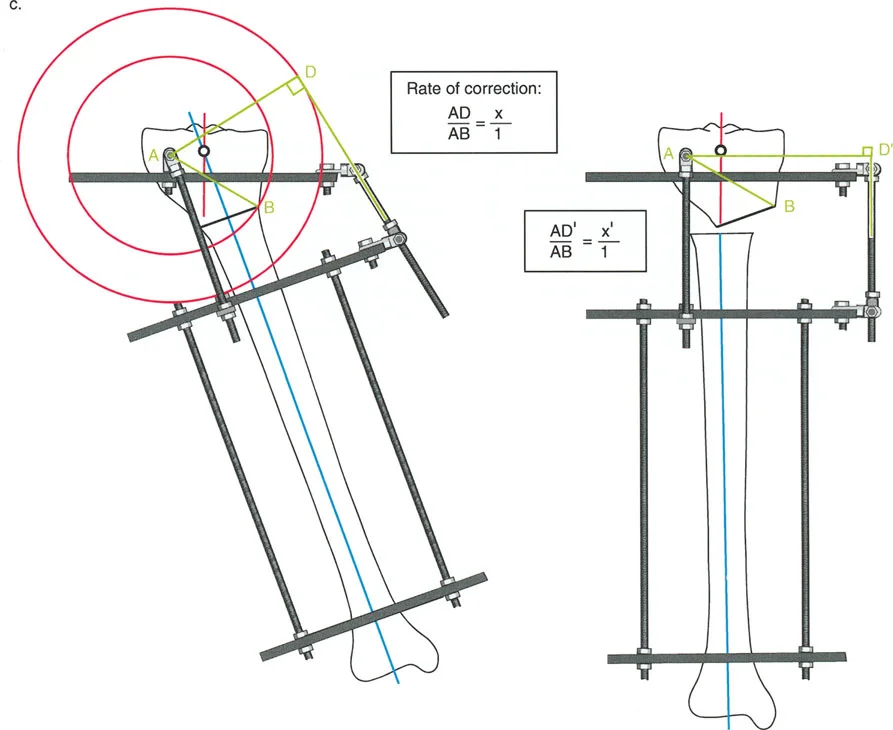 صورة توضيحية لضبط المفصلة القريبة من المفصل