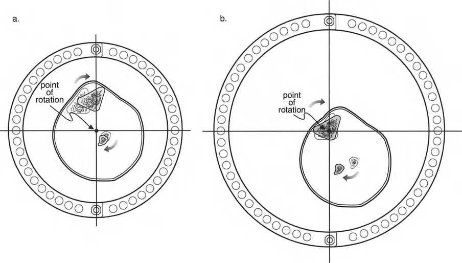 صورة طبية: تصحيح تشوهات العظام بتقنيات بالي المتقدمة الدليل الشامل للمرضى مع الأستاذ الدكتور محمد هطيف