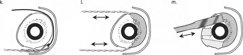 صورة طبية: تصحيح تشوهات العظام بتقنيات بالي المتقدمة الدليل الشامل للمرضى مع الأستاذ الدكتور محمد هطيف