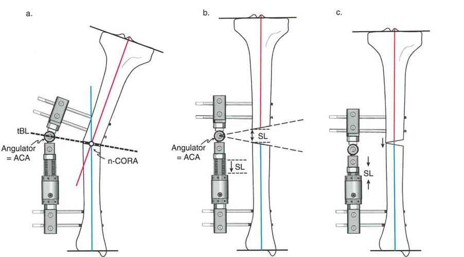 صورة توضيحية لاستخدام الدبابيس النصفية