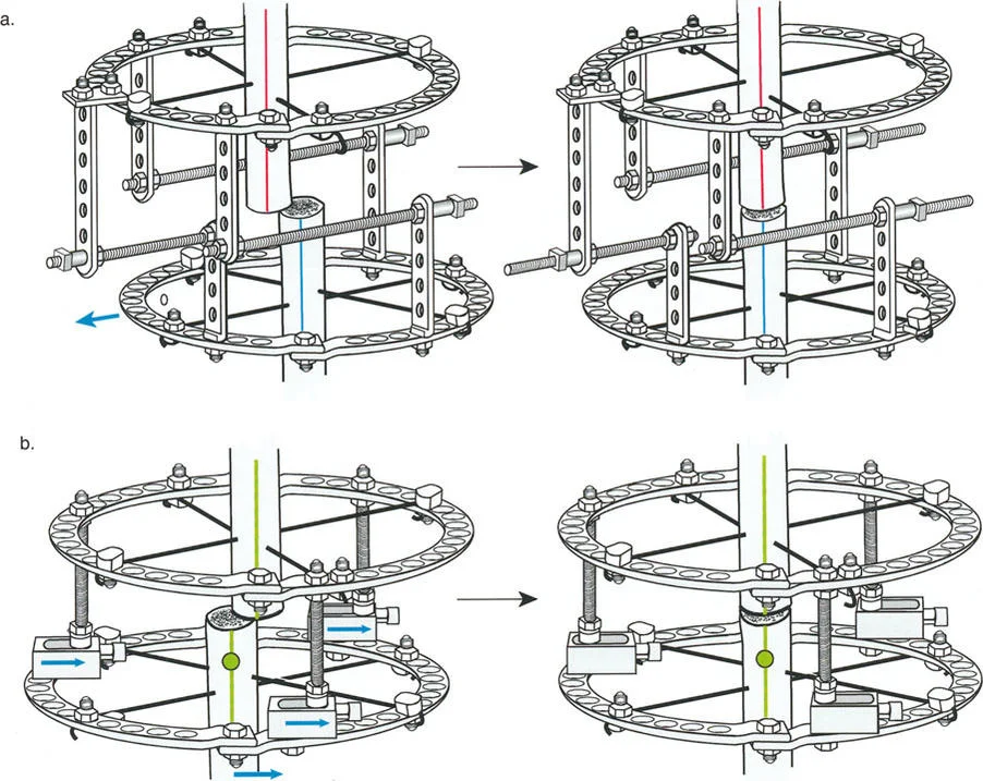 مخطط توضيحي لتجميع المفصلة القريبة من المفصل