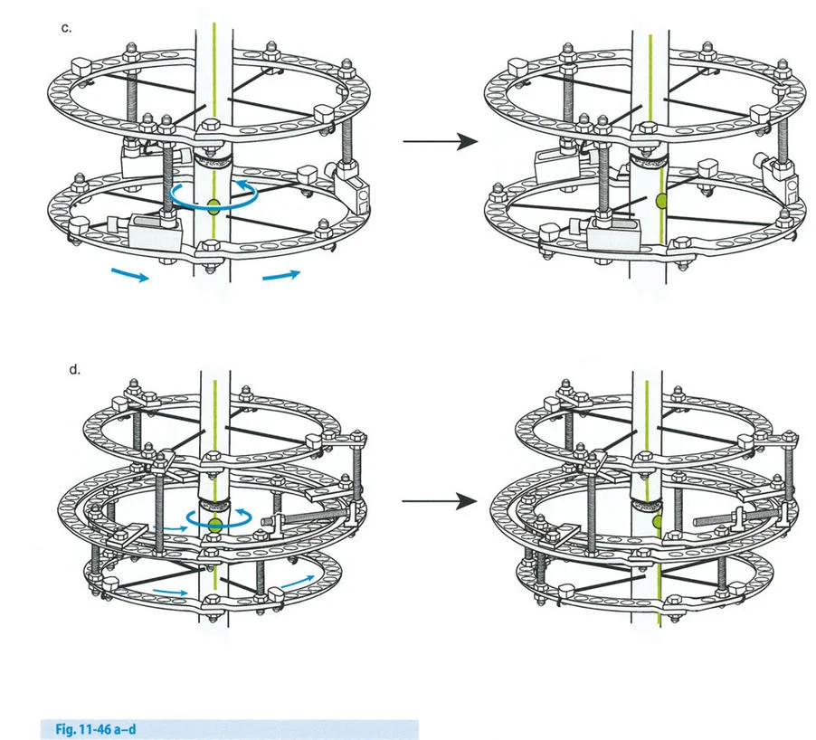 توضيح لوضع المفصلات القريبة من المفصل