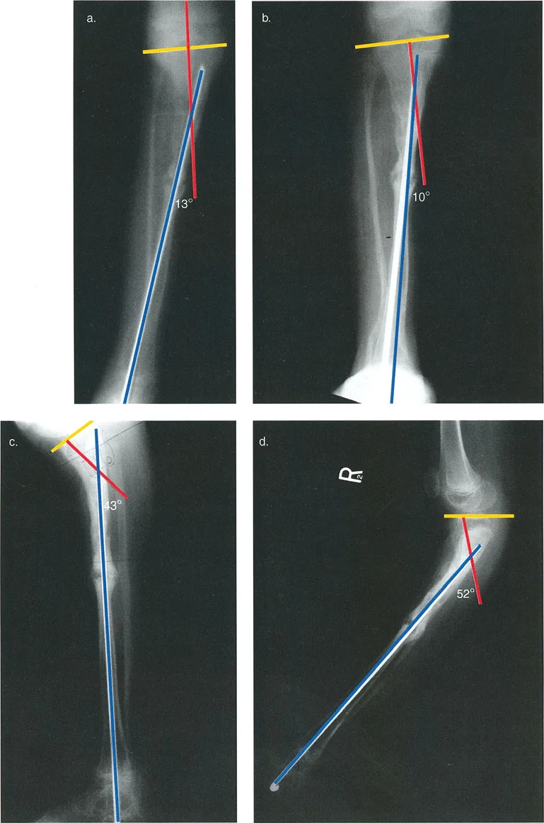 السيطرة الكاملة على تشوهات العظام المعقدة: تصحيح دقيق بستة محاور مع الأستاذ الدكتور محمد هطيف
