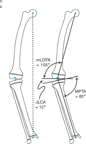 Paley's Principles: Advanced Deformity Correction for Lower Extremity Malalignment