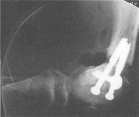 صورة طبية: تشوه خط مفصل الركبة: دليل شامل للعلاج وإعادة التأهيل مع الأستاذ الدكتور محمد هطيف