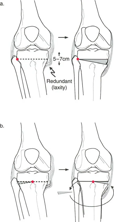 وصف طبي دقيق للمريض
