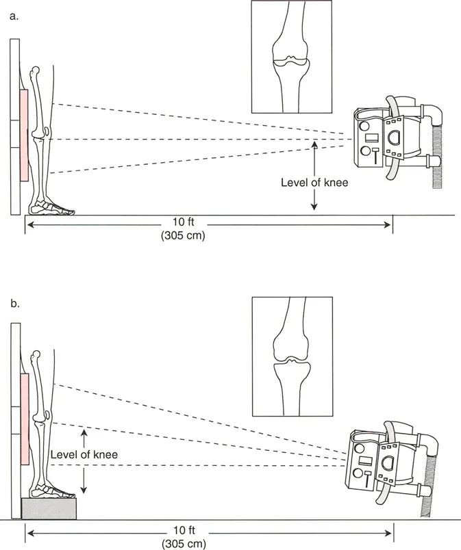 صورة طبية: اختلال محاذاة وتشوهات الأطراف السفلية في المستوى الأمامي: دليل شامل من الأستاذ الدكتور محمد هطيف