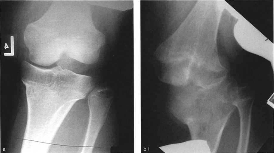صورة طبية: اختلال محاذاة وتشوهات الأطراف السفلية في المستوى الأمامي: دليل شامل من الأستاذ الدكتور محمد هطيف
