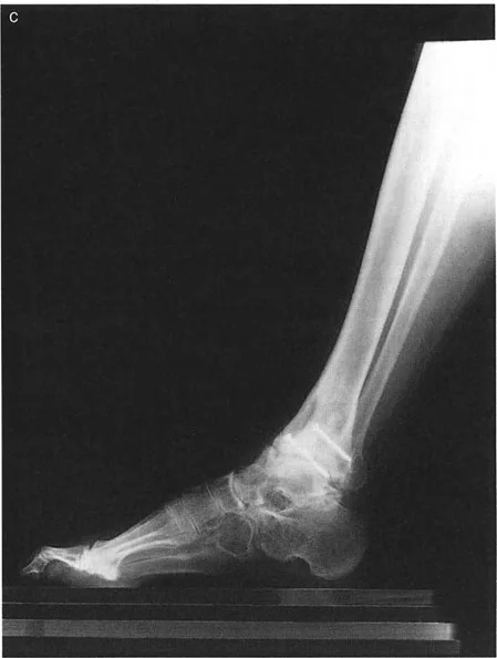 صورة طبية: اختلال محاذاة وتشوهات الأطراف السفلية في المستوى الأمامي: دليل شامل من الأستاذ الدكتور محمد هطيف