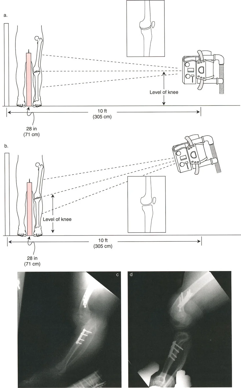 صورة طبية: اختلال محاذاة وتشوهات الأطراف السفلية في المستوى الأمامي: دليل شامل من الأستاذ الدكتور محمد هطيف