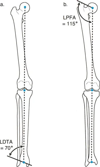 صورة طبية: اختلال محاذاة وتشوهات الأطراف السفلية في المستوى الأمامي: دليل شامل من الأستاذ الدكتور محمد هطيف