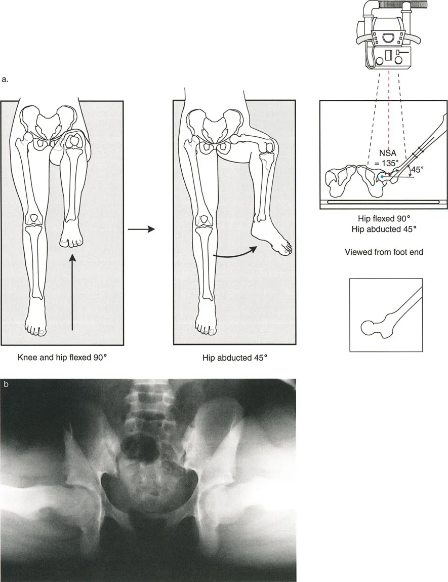 صورة طبية: اختلال محاذاة وتشوهات الأطراف السفلية في المستوى الأمامي: دليل شامل من الأستاذ الدكتور محمد هطيف