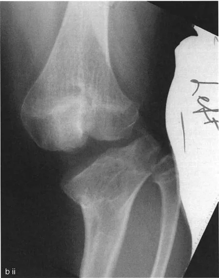 صورة طبية: اختلال محاذاة وتشوهات الأطراف السفلية في المستوى الأمامي: دليل شامل من الأستاذ الدكتور محمد هطيف