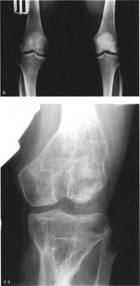 صورة طبية: اختلال محاذاة وتشوهات الأطراف السفلية في المستوى الأمامي: دليل شامل من الأستاذ الدكتور محمد هطيف