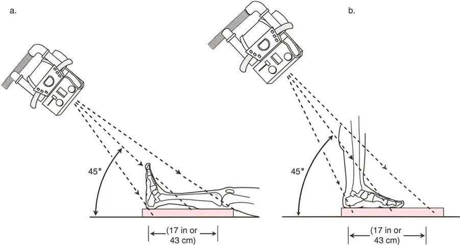 صورة طبية: اختلال محاذاة وتشوهات الأطراف السفلية في المستوى الأمامي: دليل شامل من الأستاذ الدكتور محمد هطيف
