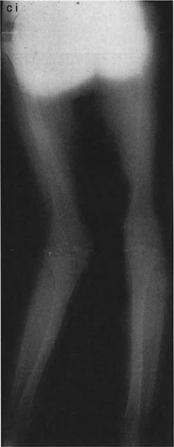 وصف طبي دقيق للمريض